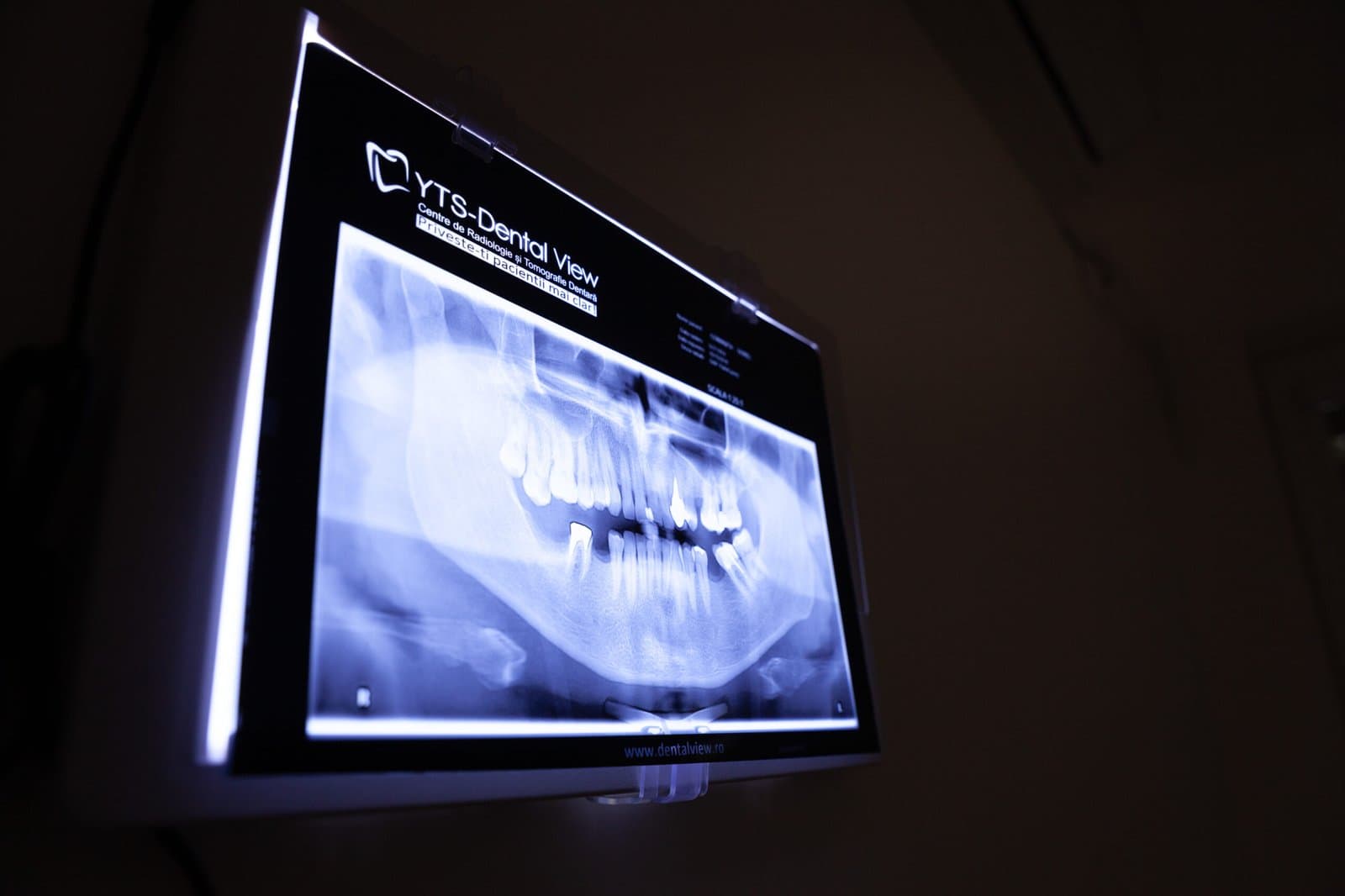 Radiologie dentară digitală pentru diagnostic